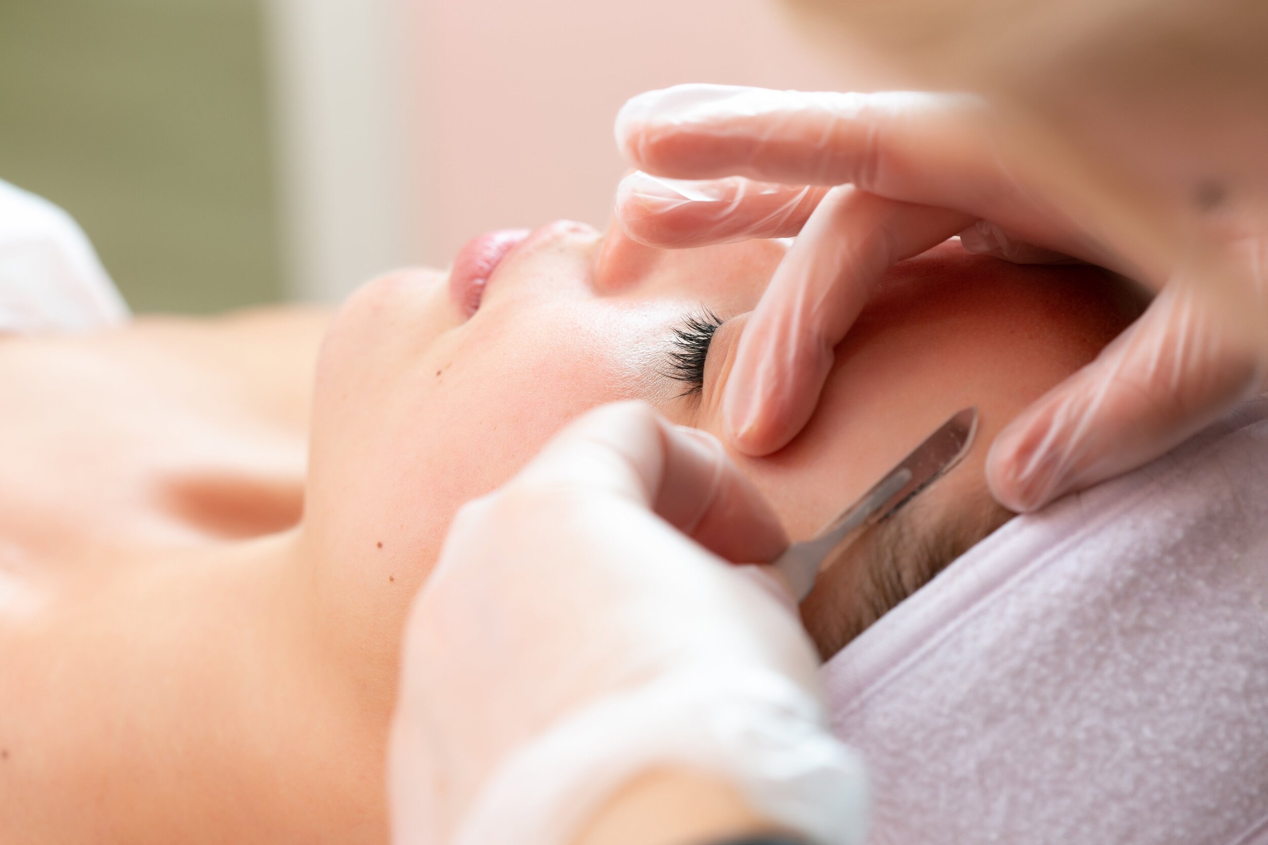 Dermaplaning pic2