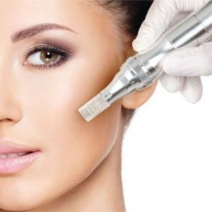 microneedling pic microneedling pic