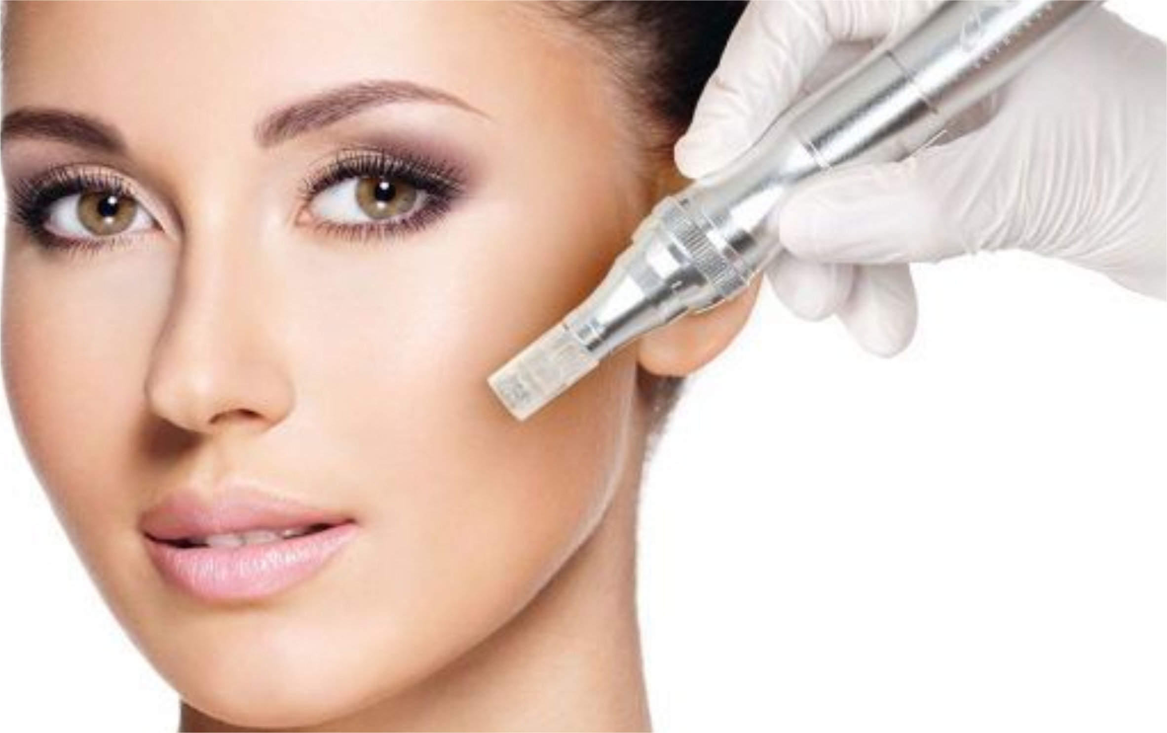 microneedling pic